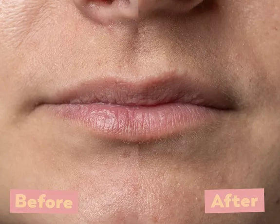 PeelLip Pomme Verte - Peeling lèvres